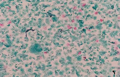 Fatores que afetam o desvanecimento de slides manchados